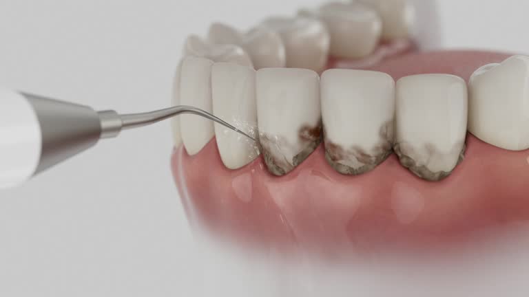 Reliable Dental Implants contractor in Bennett, CO by Smile Center Dentistry